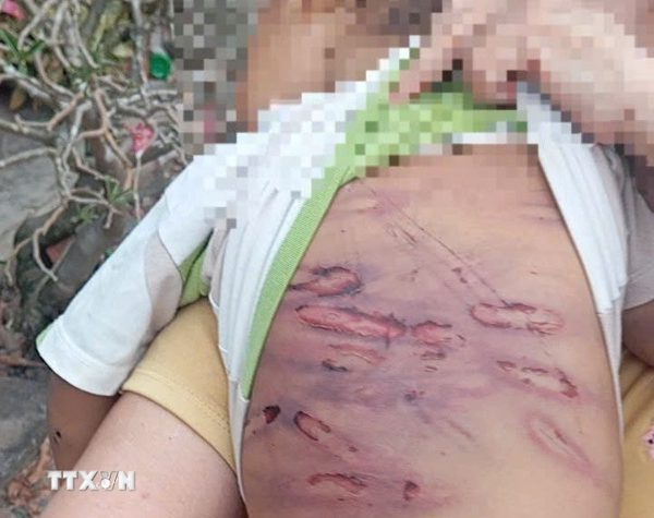Nhận diện sớm nguy cơ, phòng ngừa bạo lực đối với trẻ em