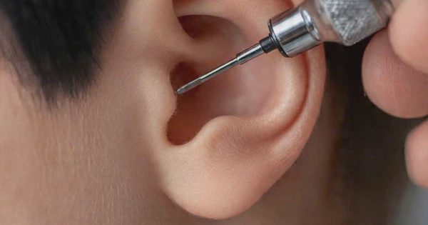 Nội soi tai phải cách nhau 7 ngày mới được bảo hiểm y tế thanh toán?
