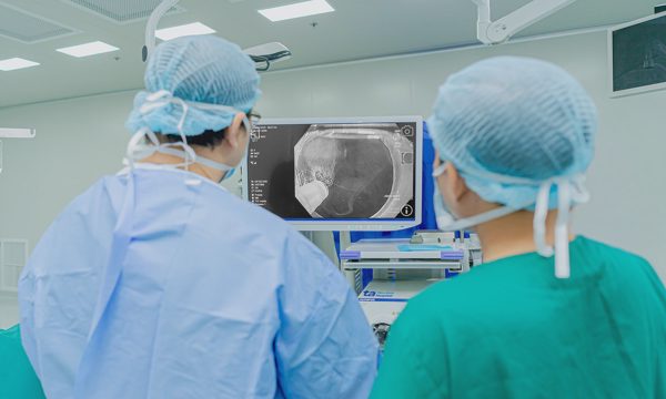 Nuốt nghẹn do co thắt tâm vị
