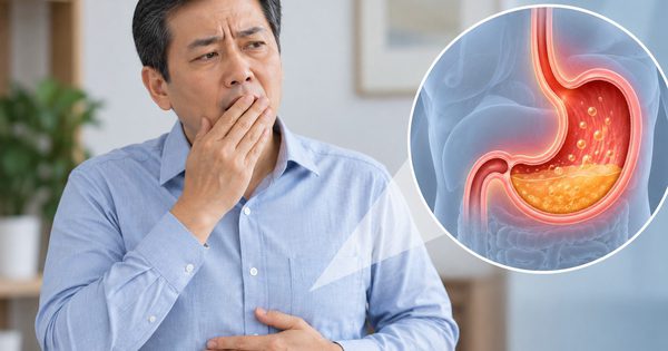 Ợ hơi thường xuyên: Khi nào cần đi khám, có phải dấu hiệu ung thư?