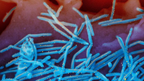 Pháp ghi nhận ca nhiễm virus hiếm gặp ở người