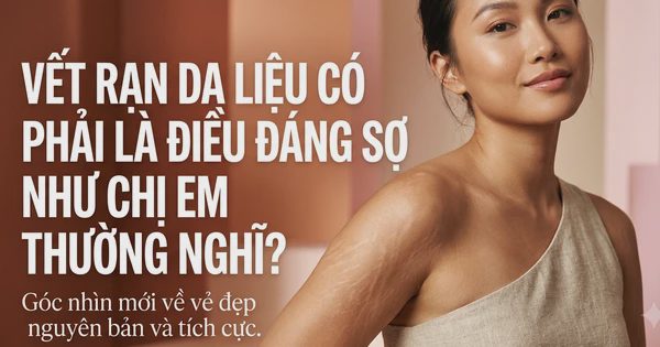 Rạn da liệu có phải là điều đáng sợ như chị em vẫn nghĩ?