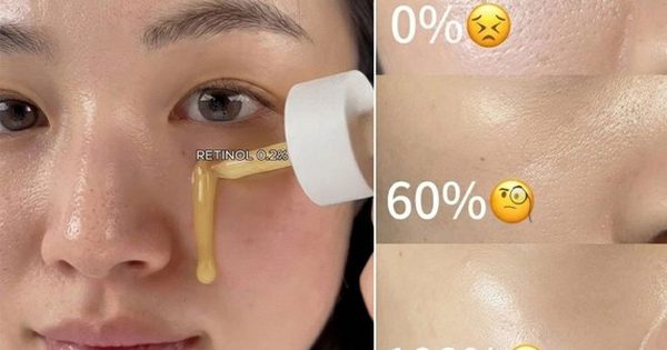 Retinol cho người mới bắt đầu: Đừng để nỗi sợ kích ứng mà quên ‘hoạt chất vàng’