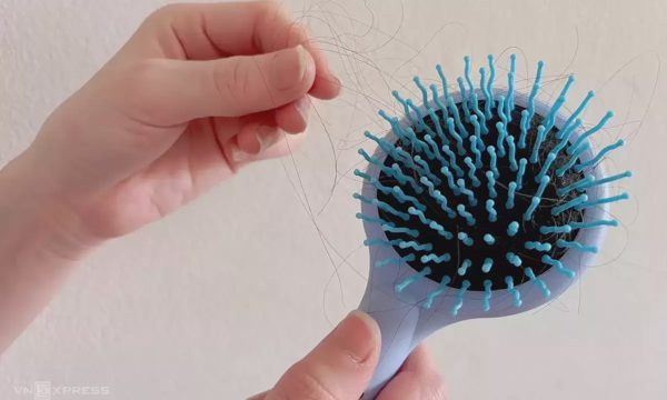 Rụng tóc nhiều do thiếu chất gì?