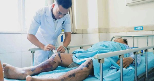 Sau hành trình sinh tử trên biển, 3 ngư dân tiếp tục điều trị tại bệnh viện