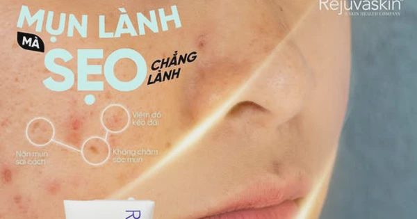 Sẹo rỗ không phải ‘một loại’: Vì sao nhiều người điều trị mãi vẫn không đẹp?