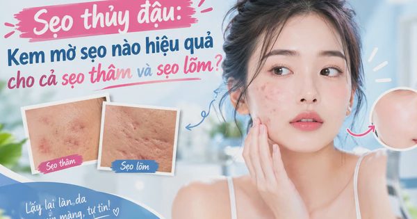 Sẹo thủy đậu: Kem mờ sẹo nào hiệu quả cho cả sẹo thâm và sẹo lõm?