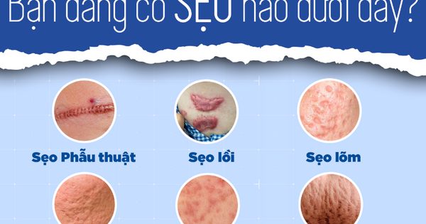 Sẹo trên mặt phải làm sao khi đã dùng đủ loại kem vẫn không cải thiện?
