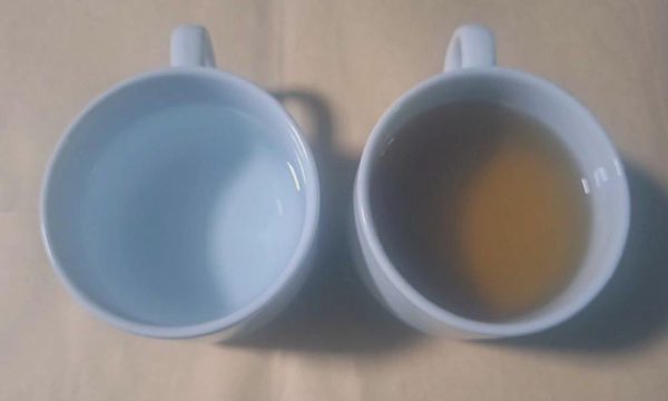 Suy thận cấp vì uống trà đặc thay nước lọc suốt hàng chục năm