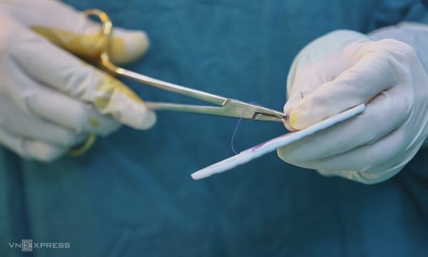Suýt hoại tử dương vật vì vòng cao su 'tăng khoái cảm'