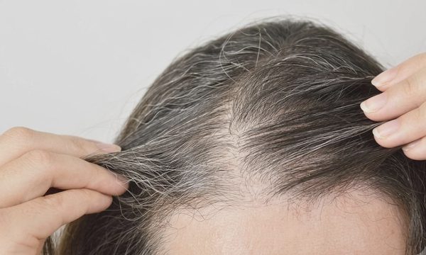 Tại sao tóc bạn bạc sớm?