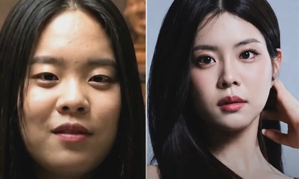 Tân hoa hậu Hàn Quốc vướng ồn ào phẫu thuật thẩm mỹ