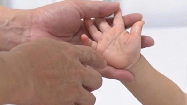 Tay chân miệng gia tăng, cảnh báo những dấu hiệu chuyển nặng dễ bị bỏ sót
