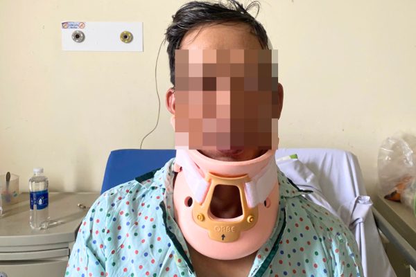 Té ngã võng, người đàn ông 43 tuổi gãy đốt sống cổ