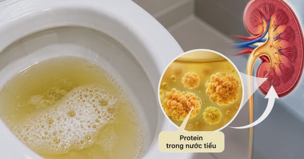 Thận yếu: Bác sĩ dặn đừng bỏ qua dấu hiệu đầu tiên này