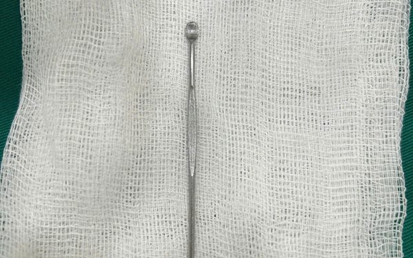Thiếu niên 14 tuổi nhập viện sau khi đưa que lấy ráy tai dài 12cm vào niệu đạo