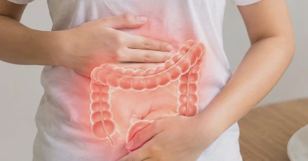 Thói quen giúp giảm nguy cơ ung thư đại tràng
