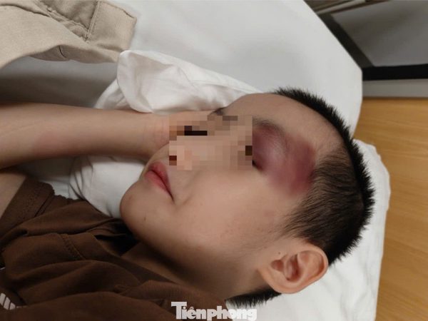 Thông tin mới vụ bé trai 6 tuổi bị chấn thương sọ não khi gửi tại cơ sở can thiệp