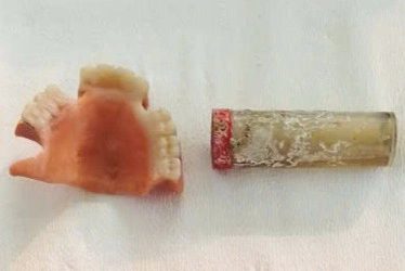 Tìm thấy hàm răng giả, vải thêu có chữ trong phần mộ liệt sĩ ở Cà Mau