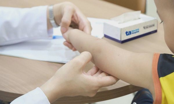 Trẻ nổi mẩn đỏ có phải dị ứng?