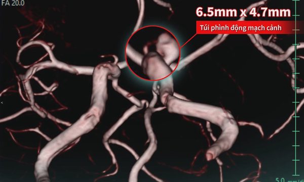 Trì hoãn khám sức khỏe để ưu tiên chăm sóc gia đình