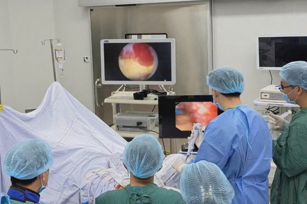 Triển khai kỹ thuật ECIRS điều trị thành công sỏi thận san hô phức tạp