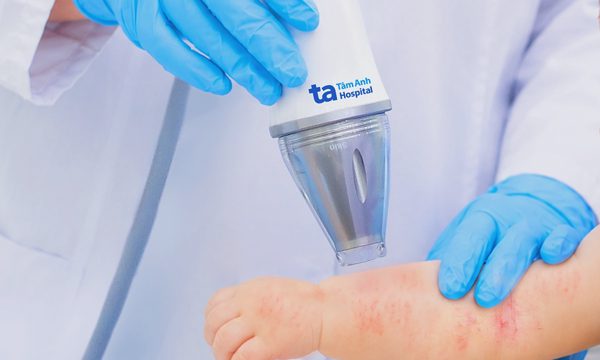Triệu chứng nhiễm trùng da ở trẻ em