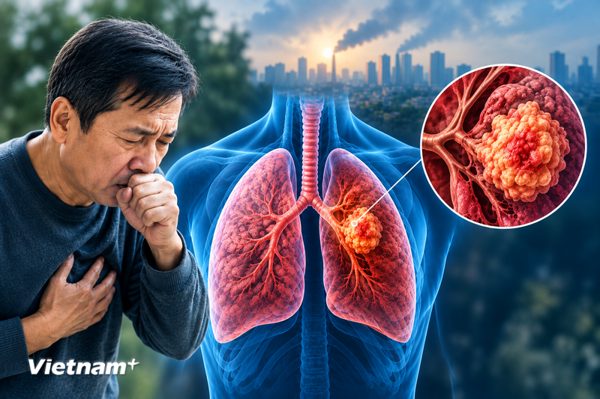 Trung Quốc ghi nhận hơn 5 triệu ca ung thư mới, tỷ lệ tử vong theo tuổi giảm