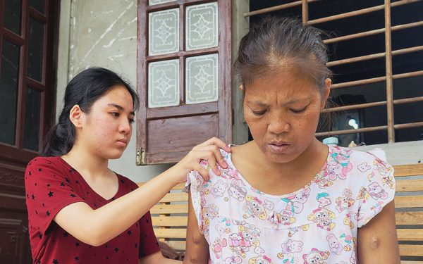 Trường ĐH Kinh tế (Đại học Huế) miễn học phí, tặng 40 triệu cho nữ sinh viên chăm mẹ suy thận