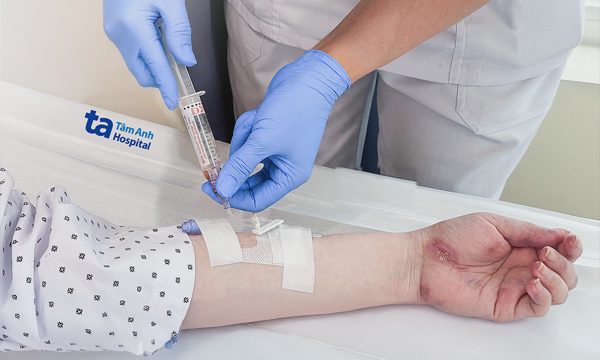 Truyền thuốc sinh học ngăn lupus ban đỏ bùng phát