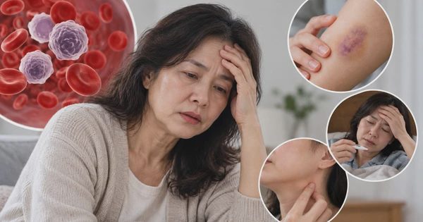 Ung thư máu: Bác sĩ lưu ý những dấu hiệu bất thường không nên bỏ qua