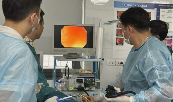 Ung thư tiêu hóa chiếm hơn 37% số ca tử vong do ung thư tại Việt Nam