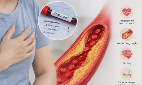 Vai trò của cholesterol đối với cơ thể