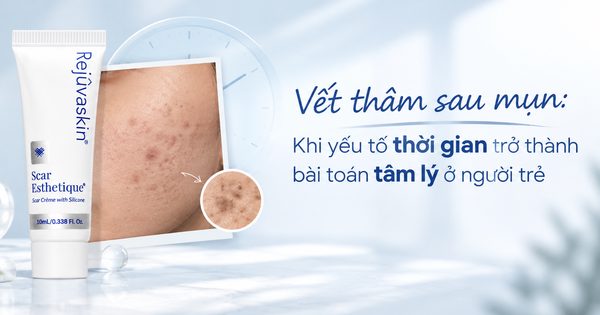 Vết thâm sau mụn: Khi yếu tố thời gian trở thành bài toán tâm lý ở người trẻ