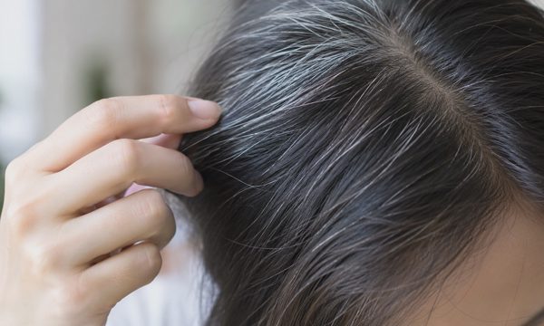 Vì sao tóc bạc khi bạn còn trẻ?