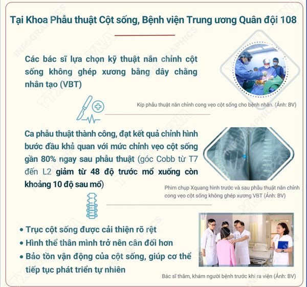 Việt Nam lần đầu phẫu thuật thành công nắn chỉnh vẹo cột sống không ghép xương