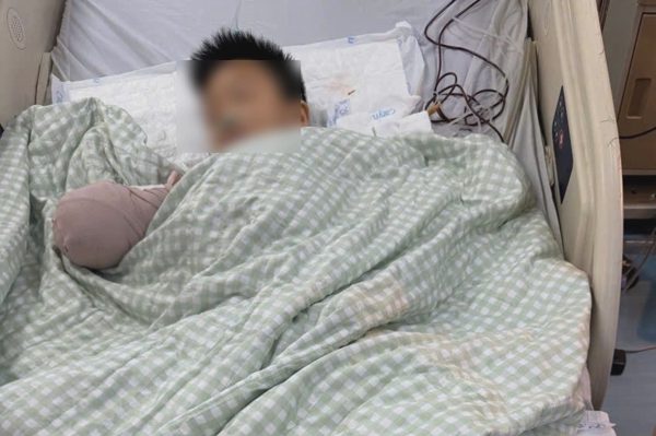 Vụ cổng chào đổ sập đè nam sinh lớp 3: Bác sĩ tạm nối bàn tay vào chân