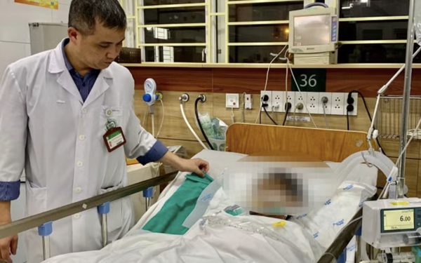 Vụ hơn 40 người nhập viện nghi ngộ độc khí clo: Có nạn nhân suy hô hấp nặng, tổn thương giác mạc