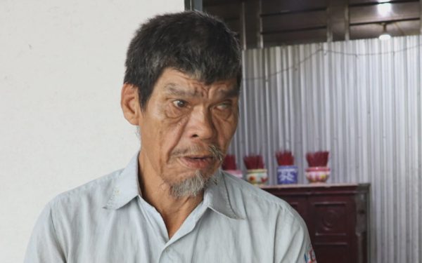 Vụ người đàn ông cao hơn 2,1m: Chính quyền cam kết sẵn sàng hỗ trợ