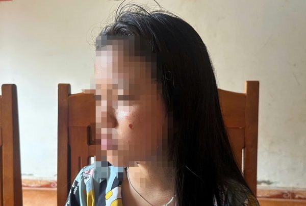 Vụ nữ sinh lớp 10 bị đánh, dí thuốc vào mặt ở Đắk Lắk: Nạn nhân không dám đi học