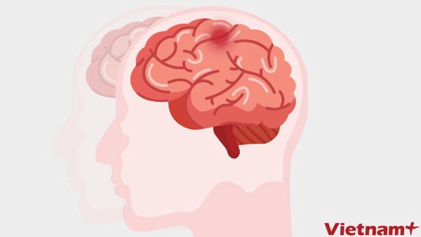 Xét nghiệm di truyền xác định loại khối u não trong chưa đầy 2 giờ