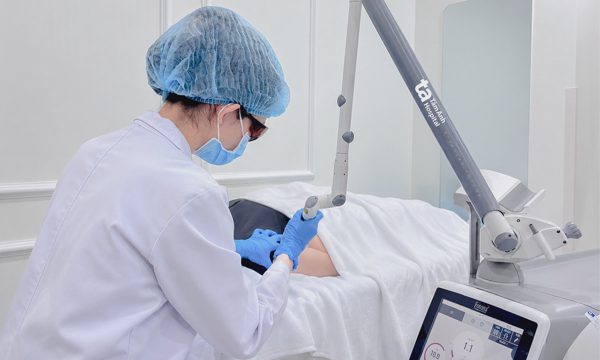 Xóa xăm bằng laser
